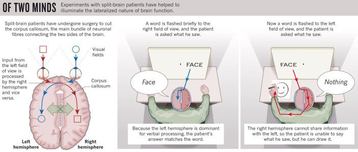 آزمایش روانشناختی مغز تقسیمشده (The Split-Brain Experiment): تقسیم مغز و کشف ناشناختههای ذهن The Split-Brain Experiment