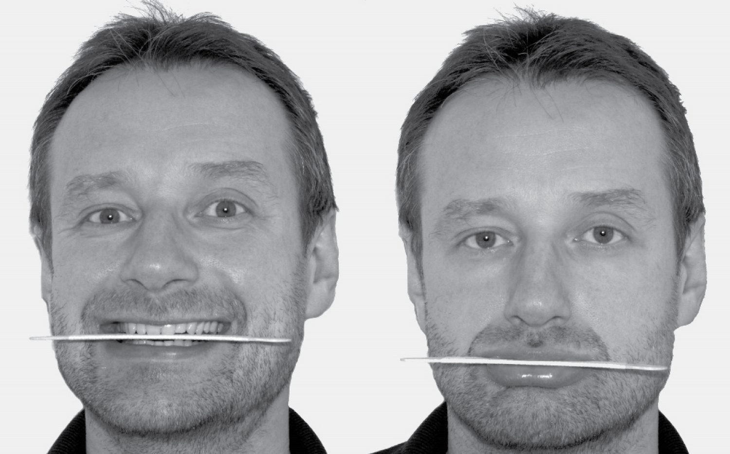 The Facial Feedback Hypothesis Experiment