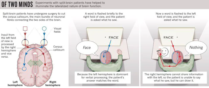 The Split-Brain Experiment